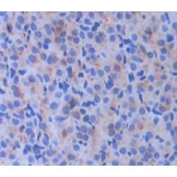 Prolylcarboxypeptidase (PRCP) Antibody
