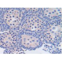 Thioredoxin-interacting Protein (TXNIP) Antibody