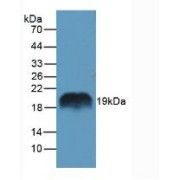 Western blot analysis of Rat Pancreas Tissue.