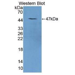 Lithostathine-1 (REG1A) Antibody