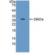 Western blot analysis of recombinant Mouse FAPa using Prolyl Endopeptidase FAP Antibody.