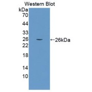 Western blot analysis of recombinant Mouse COL6a3 Protein.