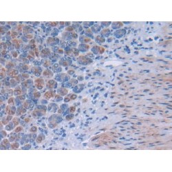 Tsukushin (TSK) Antibody