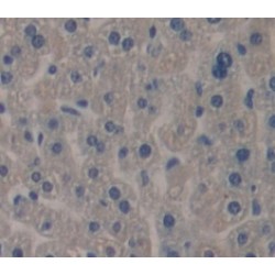 Tsukushin (TSK) Antibody