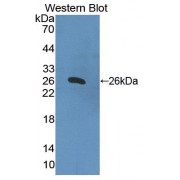 Western blot analysis of recombinant Mouse HPS4.