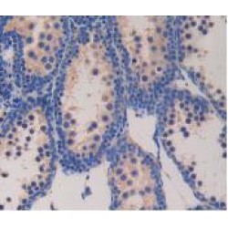 Glucagon (GCG) Antibody
