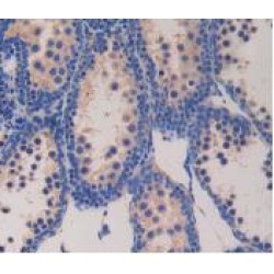 Glucagon (GC) Antibody