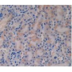 Glucagon (GCG) Antibody