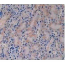 Glucagon (GC) Antibody