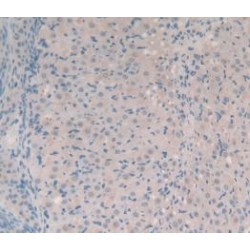 Synapsin I (SYN1) Antibody