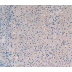 Synapsin I (SYN1) Antibody