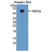 abx129464