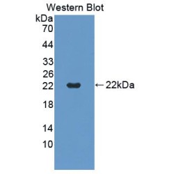 TNF Receptor Superfamily Member 5 / TNFRSF5 (CD40) Antibody