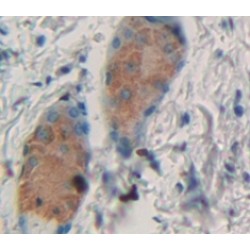 Hematopoietic Prostaglandin D Synthase (HPGDS) Antibody