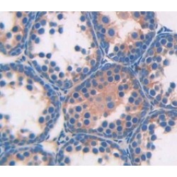 Angiotensin I Converting Enzyme (ACE) Antibody