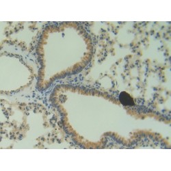 Angiogenin (ANG) Antibody