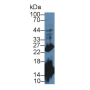 abx129498