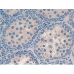Alpha-Galactosidase A (GLA) Antibody