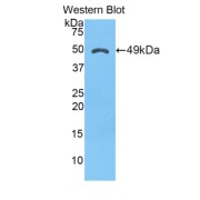 abx129510