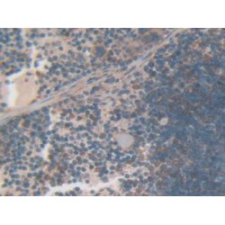 Gelsolin (GSN) Antibody