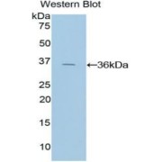 Western blot analysis of the recombinant protein.