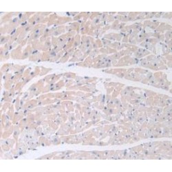 Procalcitonin (PCT) Antibody