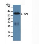 Western blot analysis of recombinant Mouse PP.