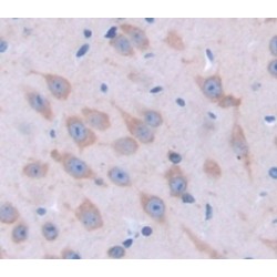 Calreticulin (CALR) Antibody