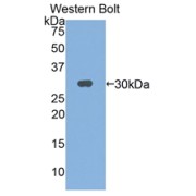 Western blot analysis of the recombinant protein.