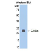 abx129560