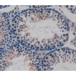 Cyclin Dependent Kinase 2 (CDK2) Antibody