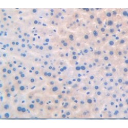 Peroxisome Proliferator Activated Receptor Delta (PPARd) Antibody