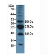 Western blot analysis of Mouse Lung Tissue.