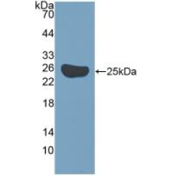 Baculoviral IAP Repeat-Containing Protein 5 (BIRC5) Antibody