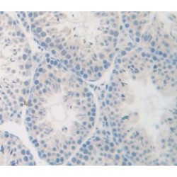 Baculoviral IAP Repeat-Containing Protein 5 (BIRC5) Antibody
