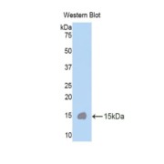 Western blot analysis of the recombinant protein.