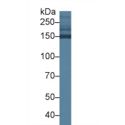 Western blot analysis of Mouse Serum, using Mouse COL2a1 Antibody (1.5 µg/ml) and HRP-conjugated Goat Anti-Rabbit antibody (<a href="https://www.abbexa.com/index.php?route=product/search&amp;search=abx400043" target="_blank">abx400043</a>, 0.2 µg/ml).