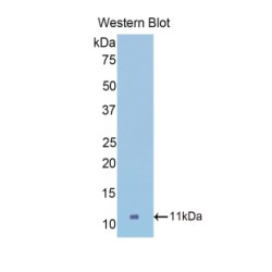 Collagen Type II Alpha 1 (COL2A1) Antibody