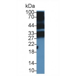 Peptidoglycan Recognition Protein 1 (PGLYRP1) Antibody
