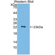 Western blot analysis of recombinant Mouse PGLYRP1.