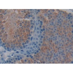Torsin 1B (TOR1B) Antibody