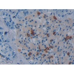 Torsin 1B (TOR1B) Antibody