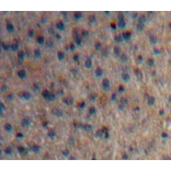 Huntingtin (HTT) Antibody