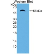 Western blot analysis of recombinant Mouse IPO8.