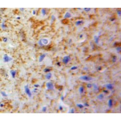 Neuroglobin (NGB) Antibody