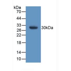 Glutathione S Transferase Theta 1 (GSTt1) Antibody