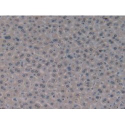 Glutathione S Transferase Theta 1 (GSTt1) Antibody