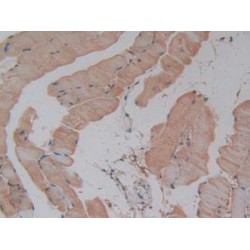 Glutathione S Transferase Theta 1 (GSTt1) Antibody
