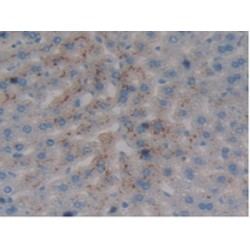 Prothrombin Fragment 1+2 (F1+2) Antibody