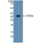 Western blot analysis of recombinant Mouse ASGR1.